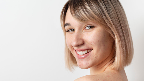 akne-prichiny-i-uhod-polnoe-rukovodstvo-po-borbe-s-vospaleniyami-kozhi