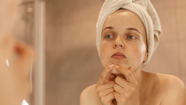 kak-izbavitsya-ot-pryschey-navsegda-effektivnye-metody-dlya-chistoy-kozhi