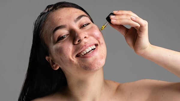 komedogennost-kak-ne-zakuporit-pory-naturalnoy-kosmetikoy