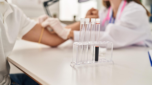 analizy-dlya-krasoty-kakie-pokazateli-nuzhno-kontrolirovat-chtoby-kozha-byla-chistoy-i-siyayuschey